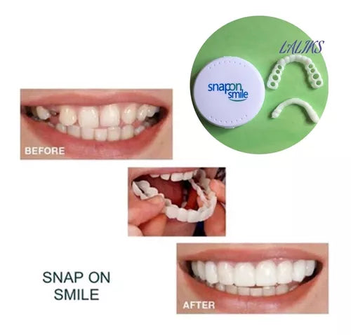 Carillas Snap On Smile, Tu sonrisa a un Click.