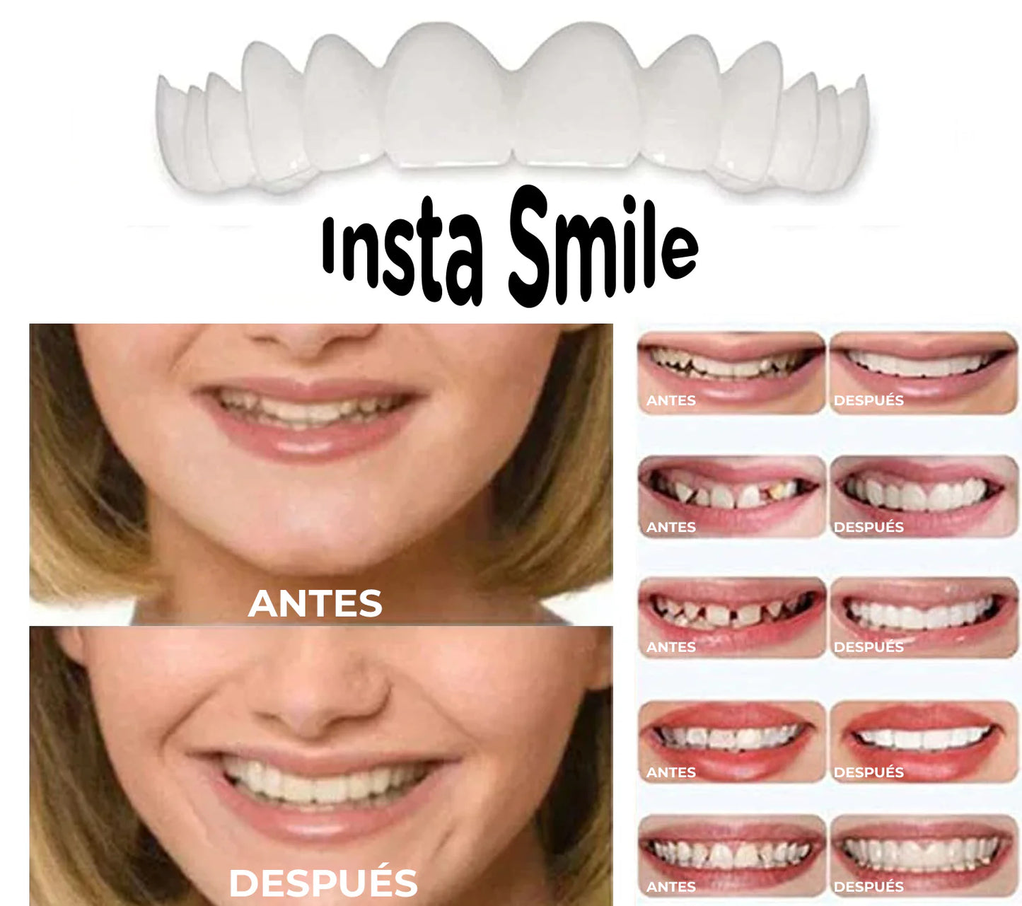 Carillas Snap On Smile, Tu sonrisa a un Click.