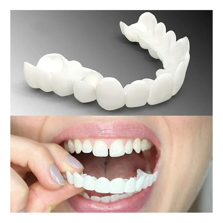 Carillas Snap On Smile, Tu sonrisa a un Click.